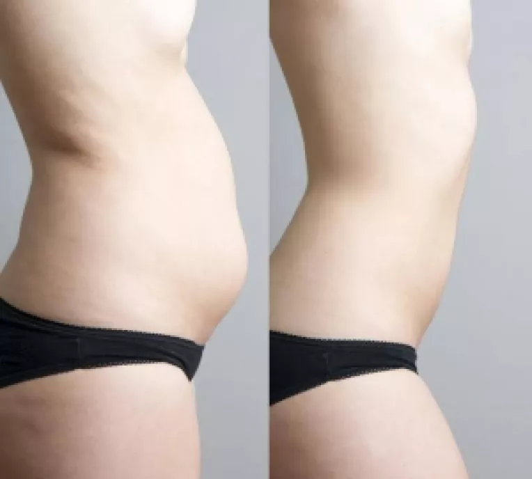 Sara Gottfried, medic ginecolog: Cresterea in greutatea este cauzata de hormoni